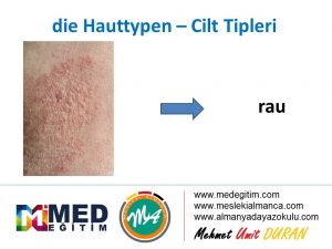 Die Hauttypen - Cilt Lekelerinin Almancası 2
