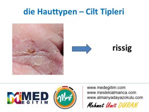Die Hauttypen - Cilt Lekelerinin Almancası 3