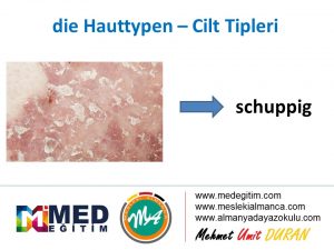 Die Hauttypen - Cilt Lekelerinin Almancası 4