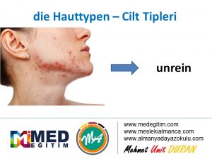 Die Hauttypen - Cilt Lekelerinin Almancası 8